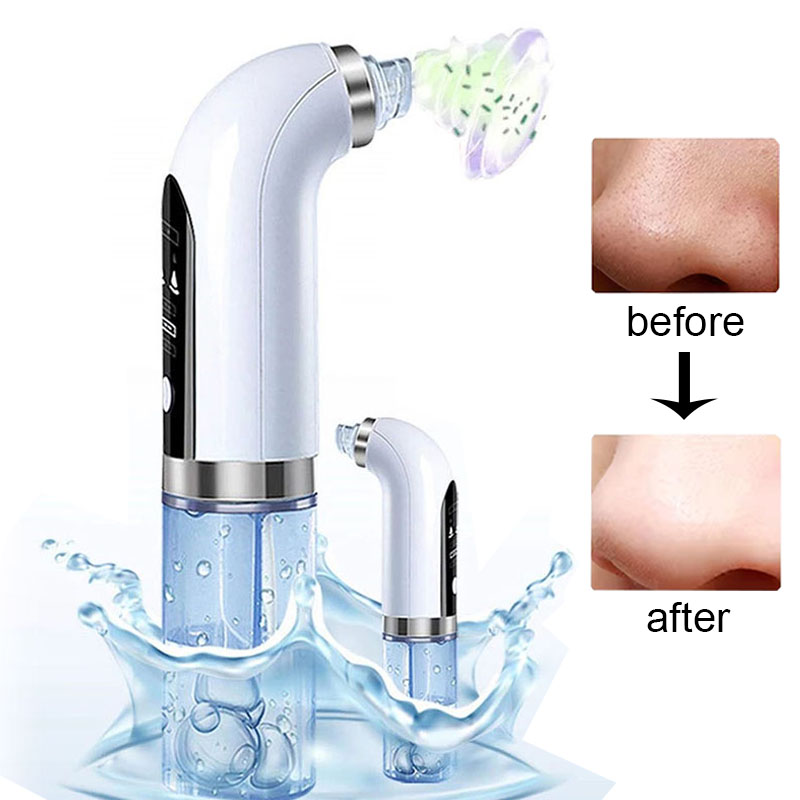 Urządzenie do mikrodermabrazji – Air Bubble Remover recenzja i cena